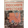 Endocardite infectioase