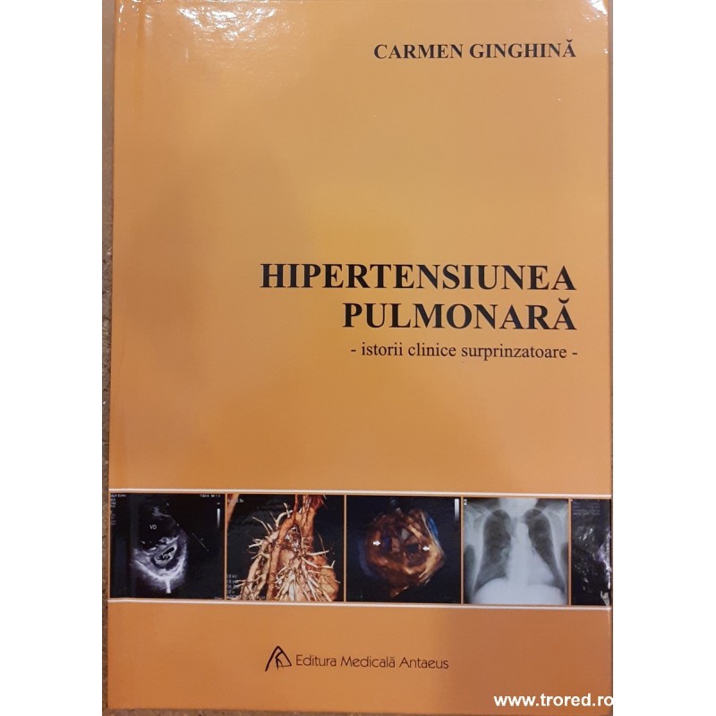Hipertensiunea pulmonara. Istorii clinice surprinzatoare