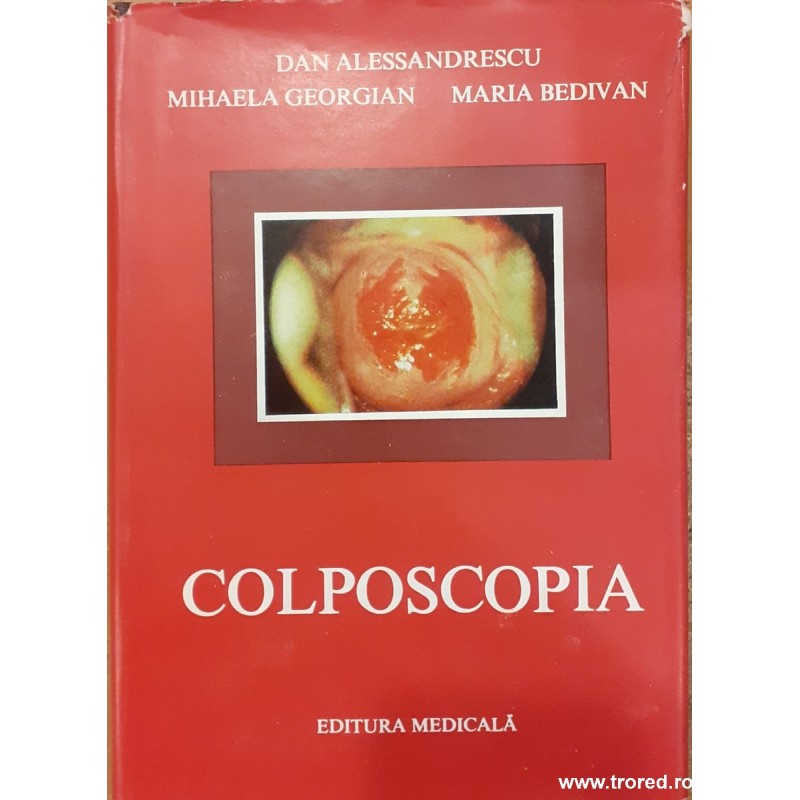 Colposcopia