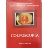 Colposcopia