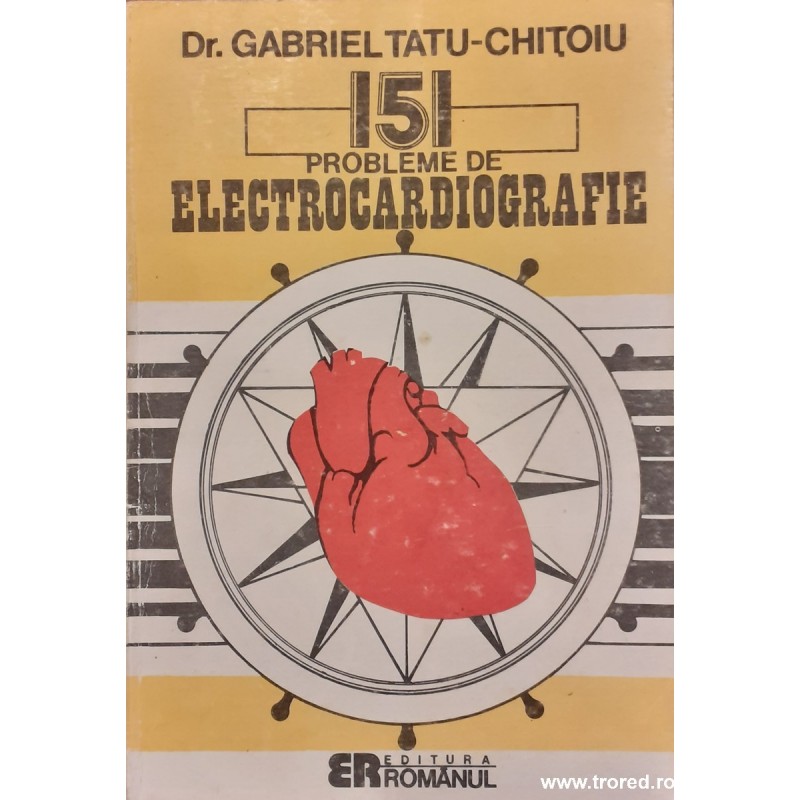 151 probleme de electrocardiografie