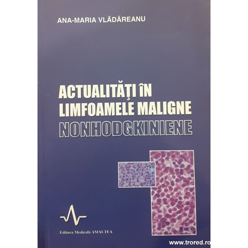 Actualitati in limfoamele maligne nonhodgkiniene