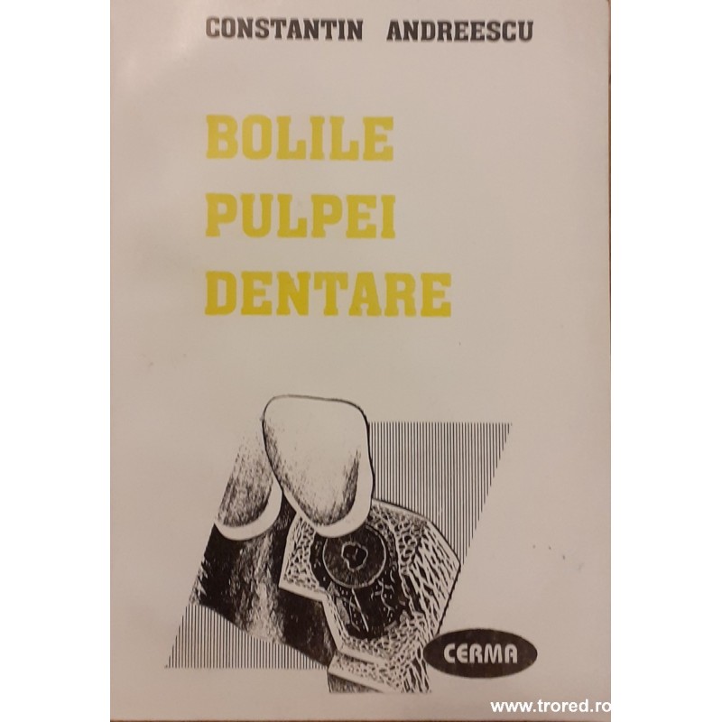 Bolile pulpei dentare