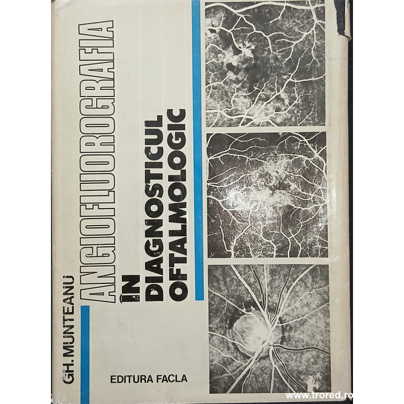 Angiofluorografia in diagnosticul oftalmologic