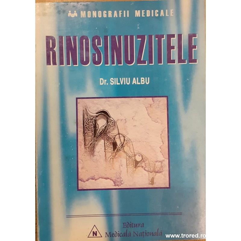 Rinosinuzitele